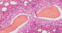 Bone marrow trephine H&E (10 x hpf)