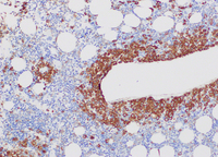 Bone marrow trephine myeloperoxidase stain    (10 x hpf)