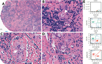 Seeing is believing: a histology textbook’s dream case of sarcoidosis