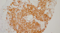 PAX 5 stain