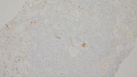 CCND1 stain