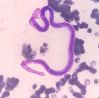 A NIGHT PROWLER - MICROFILARIA IN PERIPHERAL SMEAR