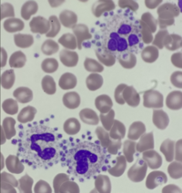 Platelet Satellitism 2