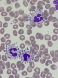 Platelet satellitism 1