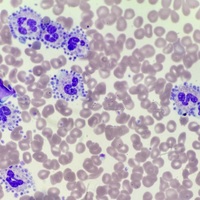 Platelet satellitism 2
