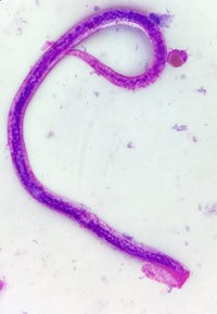 Silent Passenger: Asymptomatic Microfilaremia Unmasked by Eosinophilia