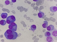 Binucleate plasma cell