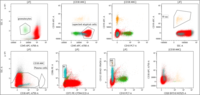 Flowcytometry of Blastoid cells shows high side scatter with CD45 bright