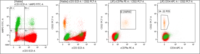 Flowcytometry shows positivity for Cytoplasmic CD3