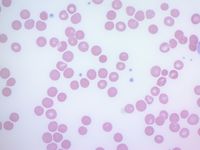 Vacuolated Erythrocytes Figure 1(a)