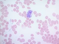 Vacuolated Erythrocytes Figure 1(b)