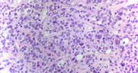 Bone marrow core biopsy (H&E 60X)