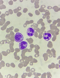 toxic granules