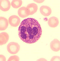 Alder Reilly Morphology