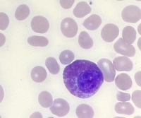 Eosinophilic Myelocyte