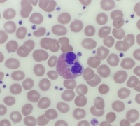 Eosinophil
