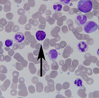 Basophil(2)