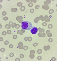 Plasma cell