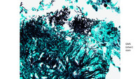 GMS Silver stain