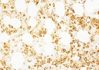 CD71 immunohistochemistry highlighting erythroid differentiation
