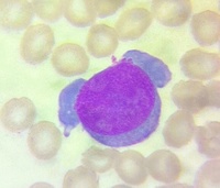 Parvovirus B19 (erythrovirus)