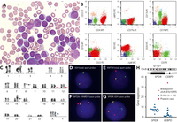 B-lymphoblastic leukemia with synchronous KMT2A::TXNRD1 and IGH::CEBPD rearrangements