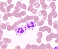 Platelet satellitism 1
