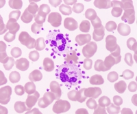 Platelet satellitism 3