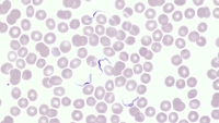 Trypomastigotes on a Blood film