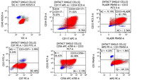 AML with biallelic CEBPA mutation with biZIP: flow cytometry