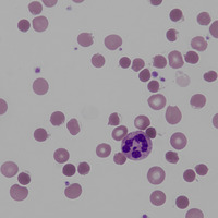 Oxidative haemolysis