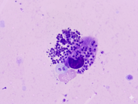 A **macrophage containing numerous intracellular Leishman-Donovan (LD) bodies (amastigotes)**.