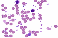 extracellular Leishman-Donovan (LD) bodies (amastigotes)