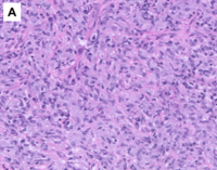Image A, H&E (20x)
