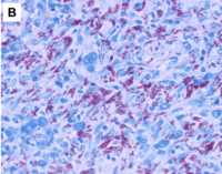 Image B, ZN (20x)