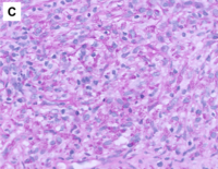 Image C, PAS (20x)