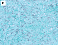 Image D, GMS (20x)