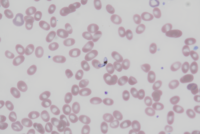 Plasmodium falciparum macrogametocyte