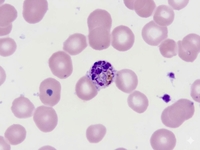 Trophozoites of P.vivax
